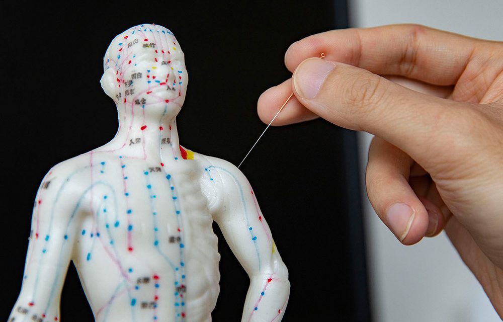 [Wellness]: Acupuncture for Better Sex and Less Stress