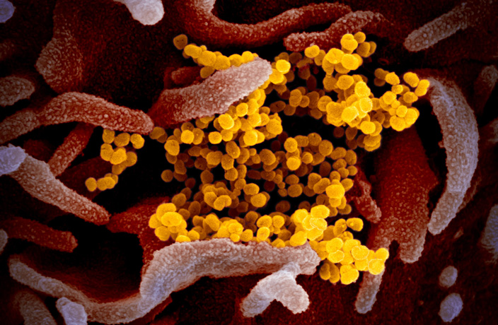 Here’s What the New Coronavirus Looks Like Super Close-up